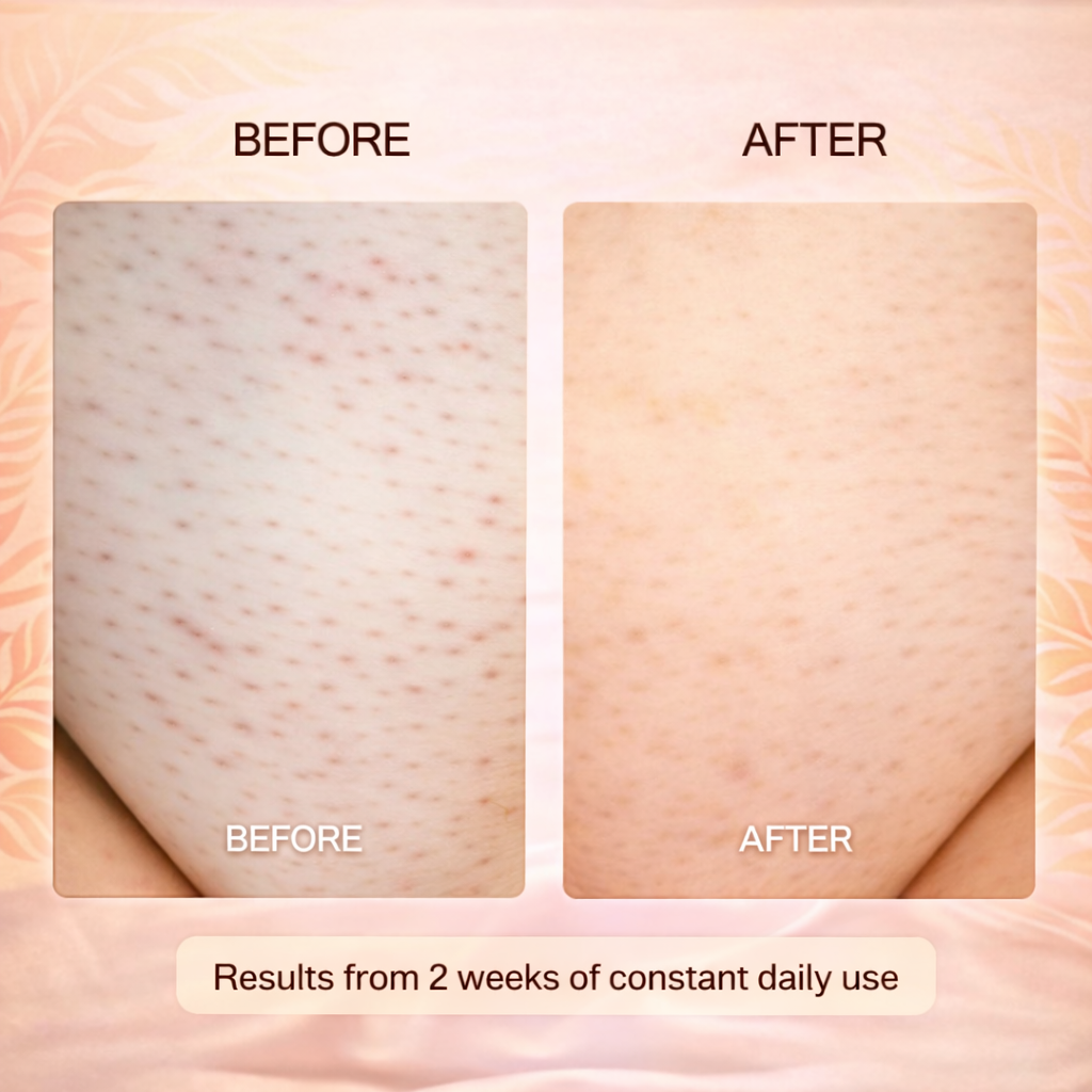 Denora Hair Removal Oil